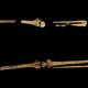 The skeletal remains of a man’s right and left leg, showing that the left foot was completely amputated years before his death.